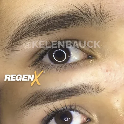 Comparaison de sourcils publiée par la marque RegenX, regard photographié sous deux angles.